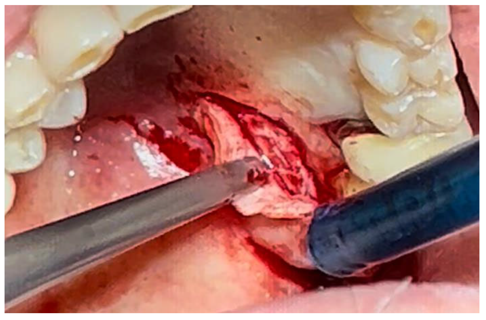 Materials 18 02642 g003