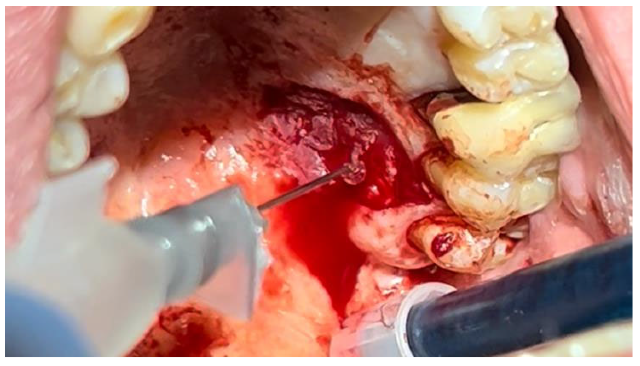 Materials 18 02642 g004