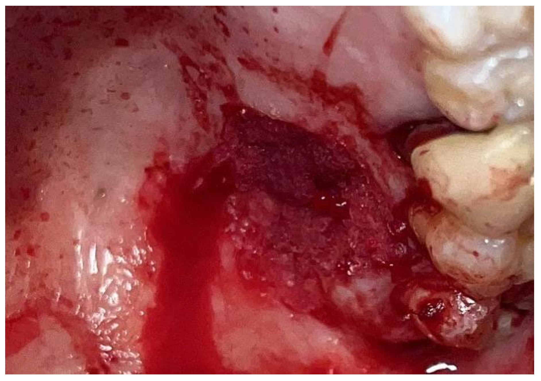 Materials 18 02642 g005