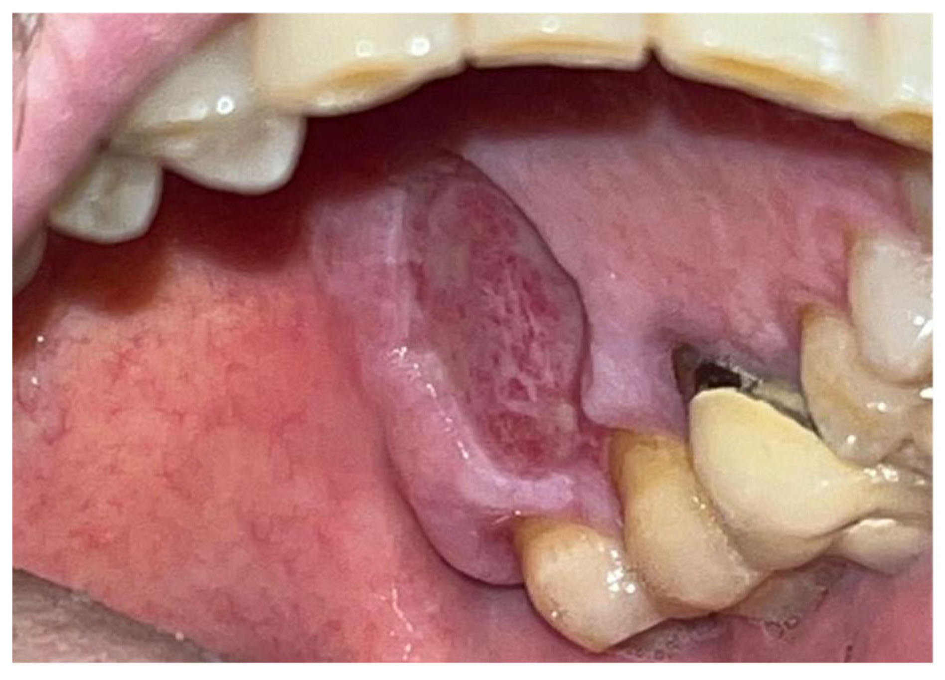 Materials 18 02642 g006