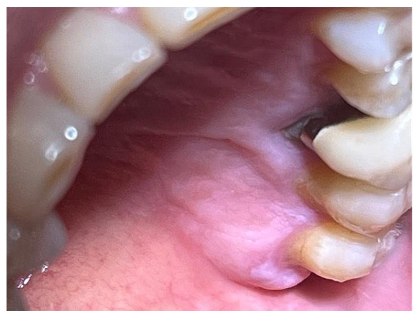 Materials 18 02642 g007