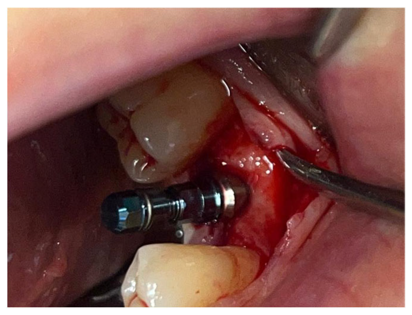 Materials 18 02642 g008