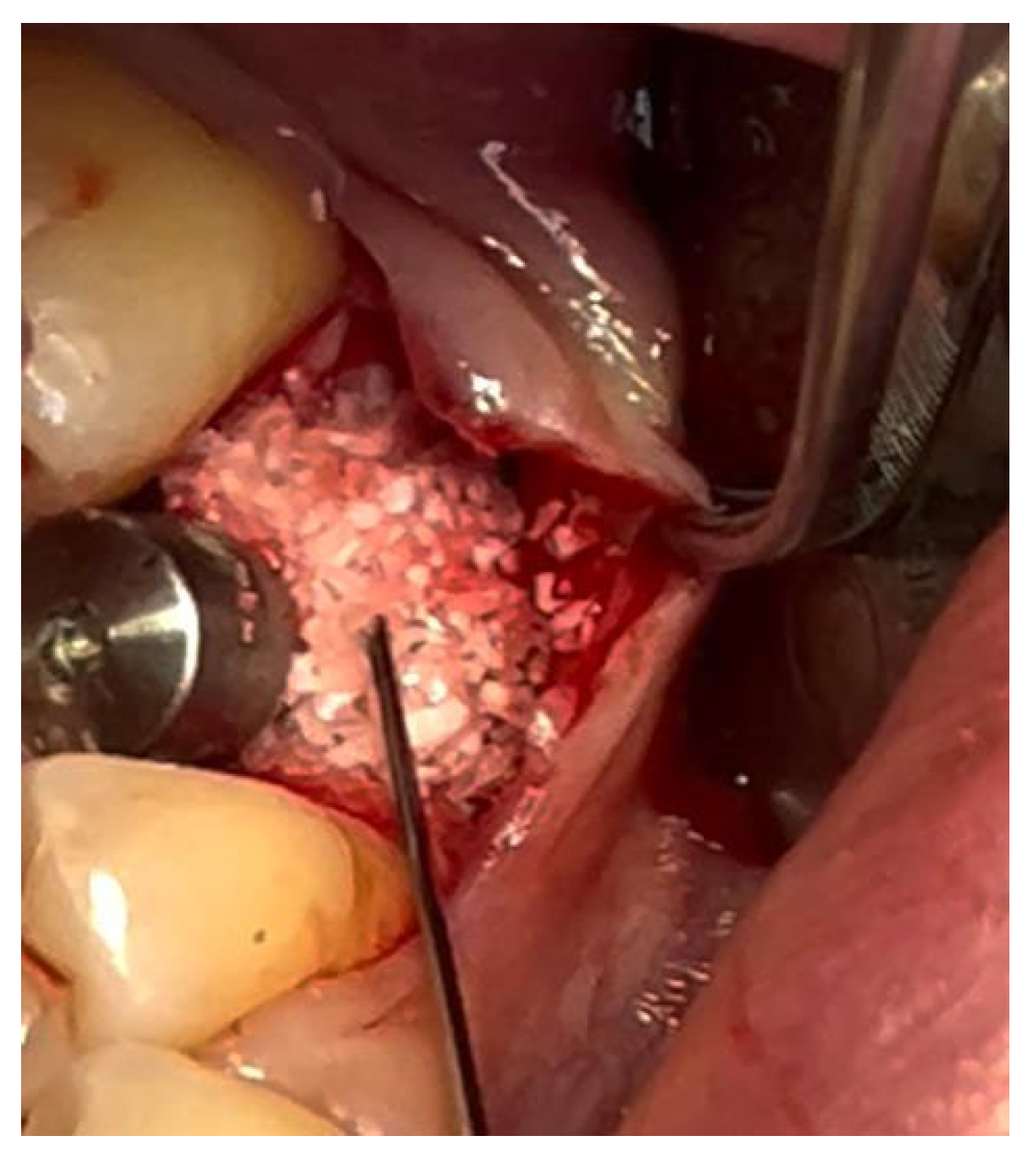 Materials 18 02642 g009