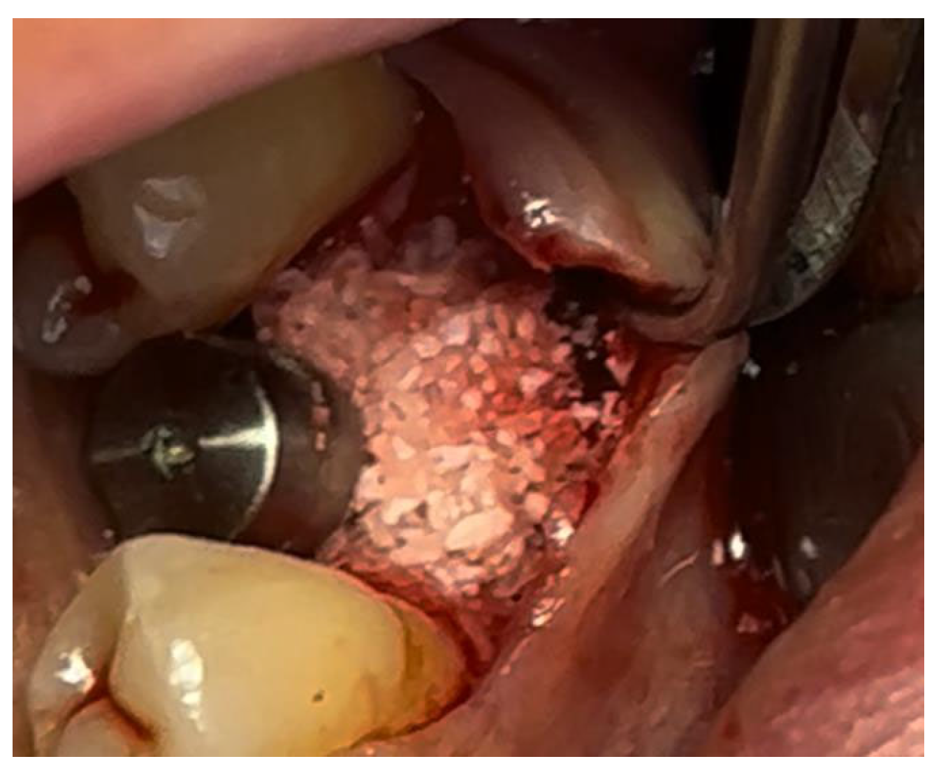 Materials 18 02642 g010