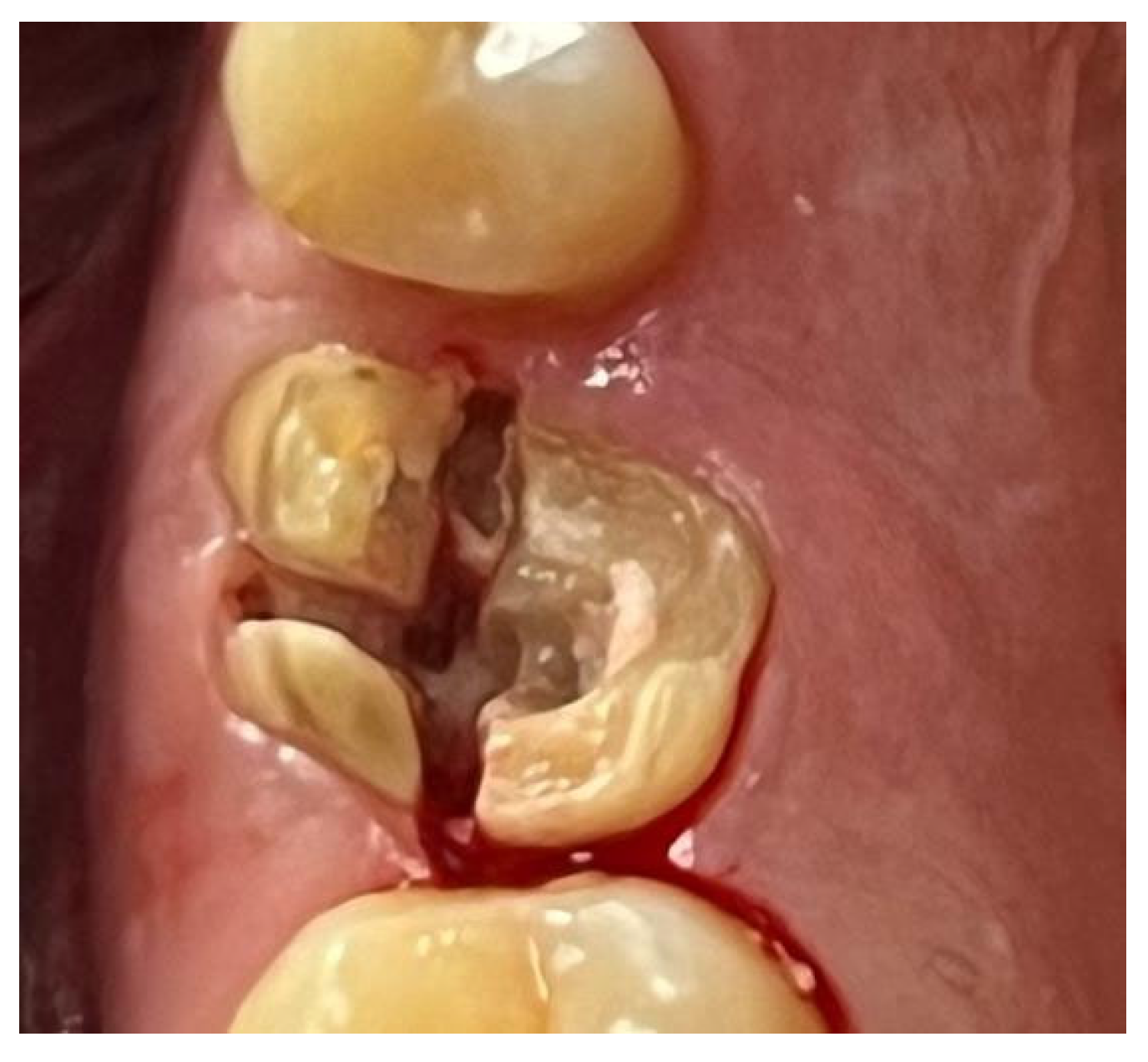 Materials 18 02642 g011