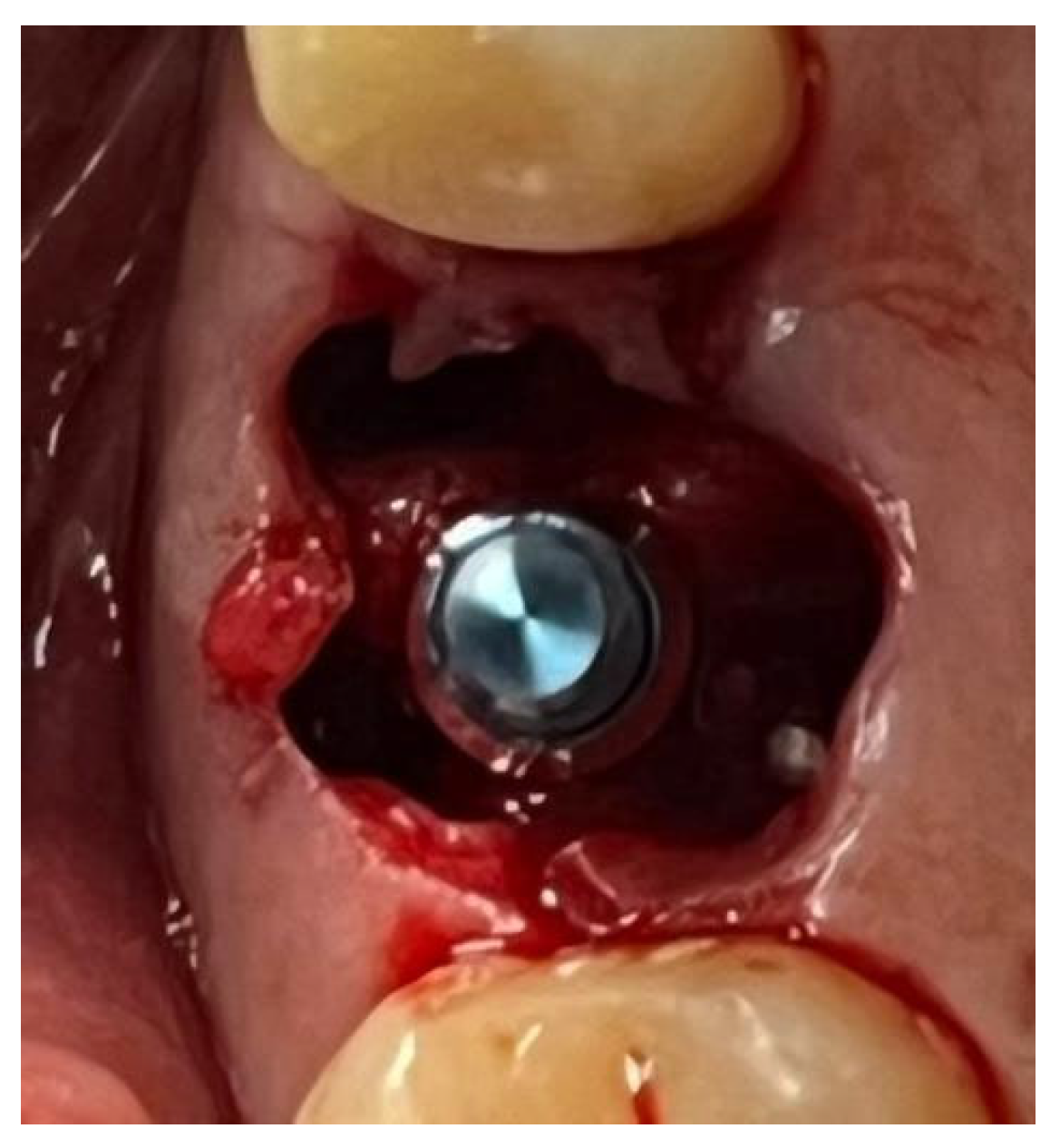 Materials 18 02642 g012