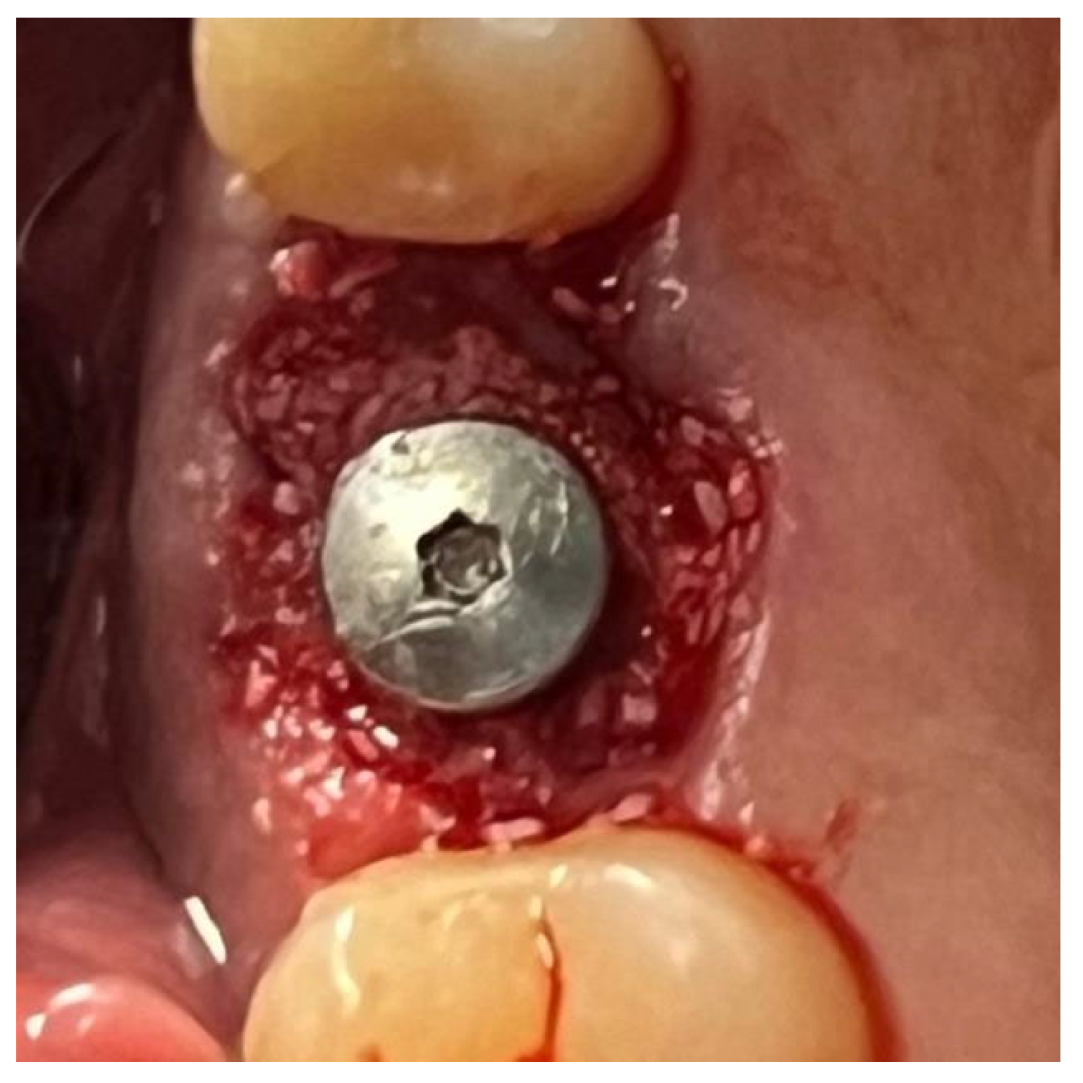 Materials 18 02642 g014