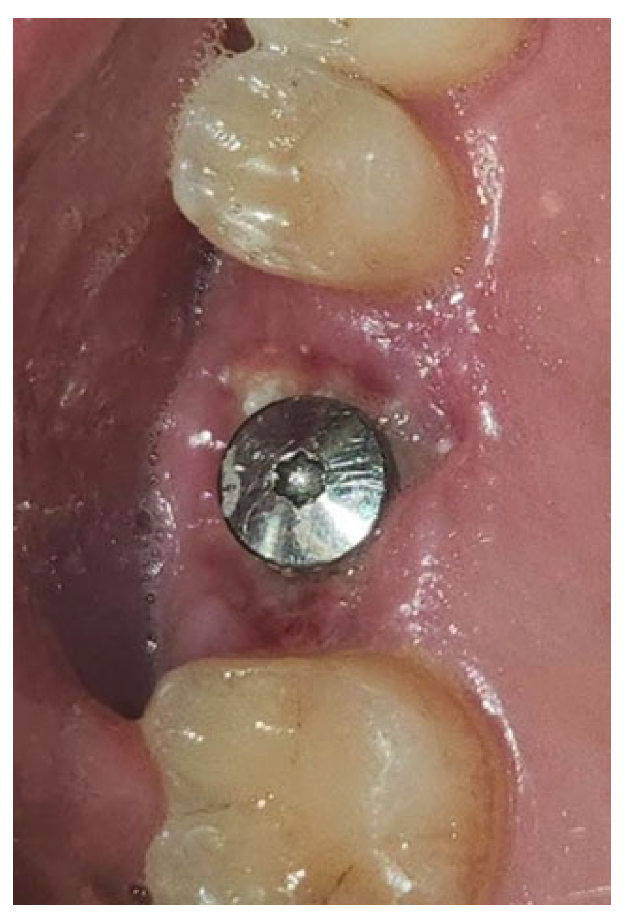 Materials 18 02642 g015