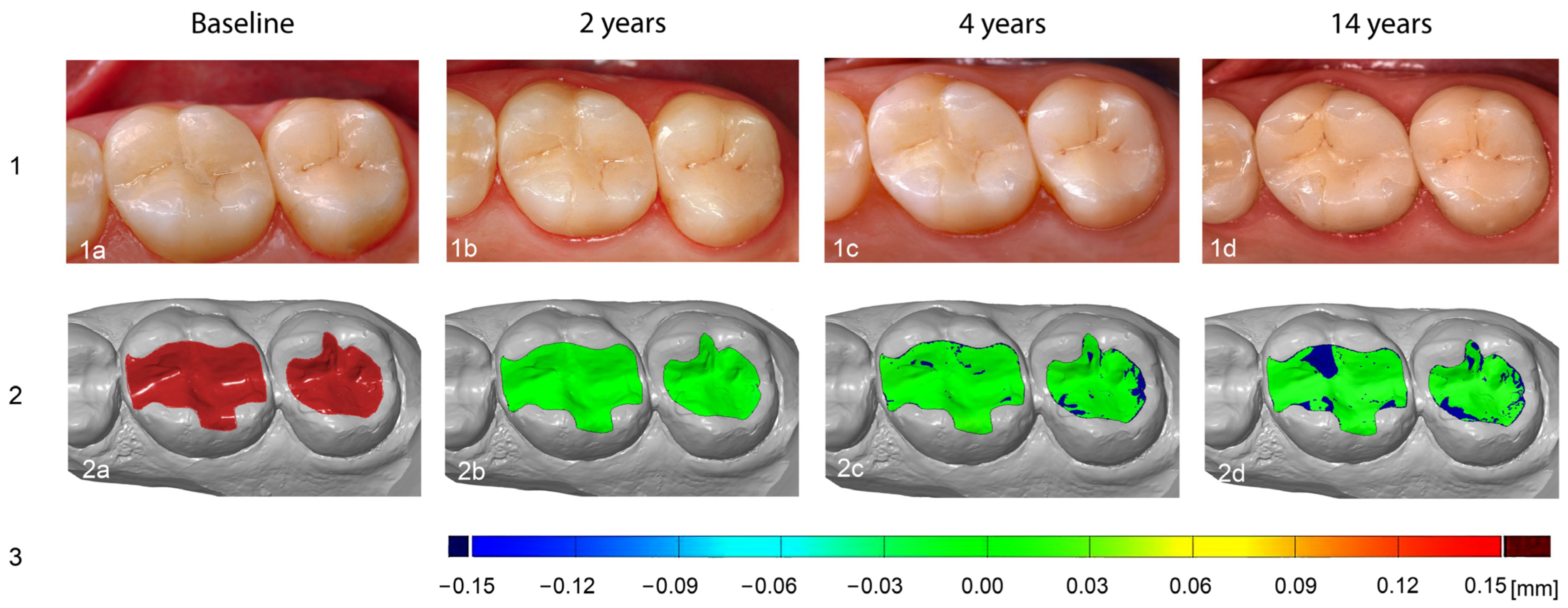 Materials 18 03446 g002