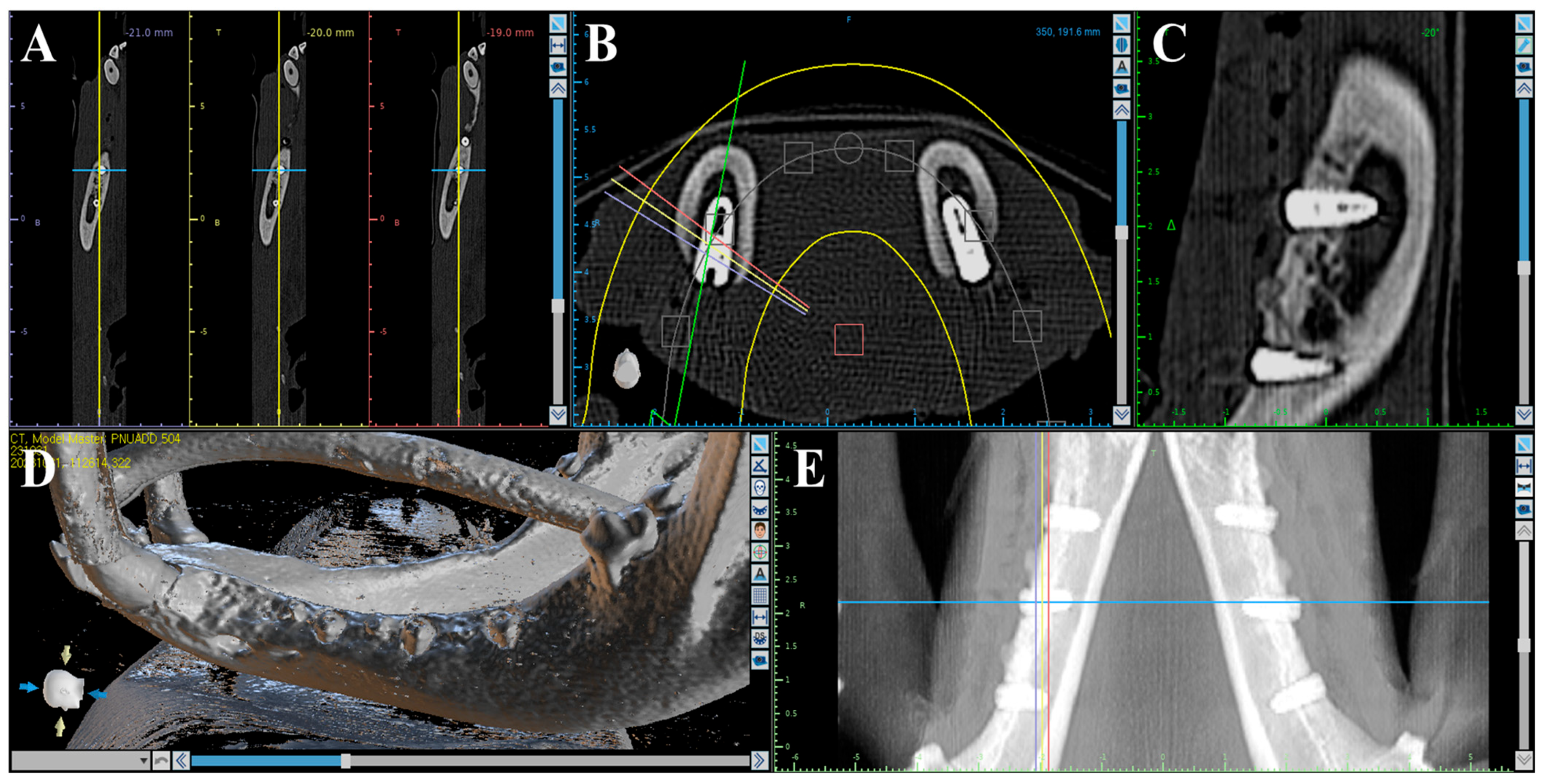 Materials 18 03582 g002