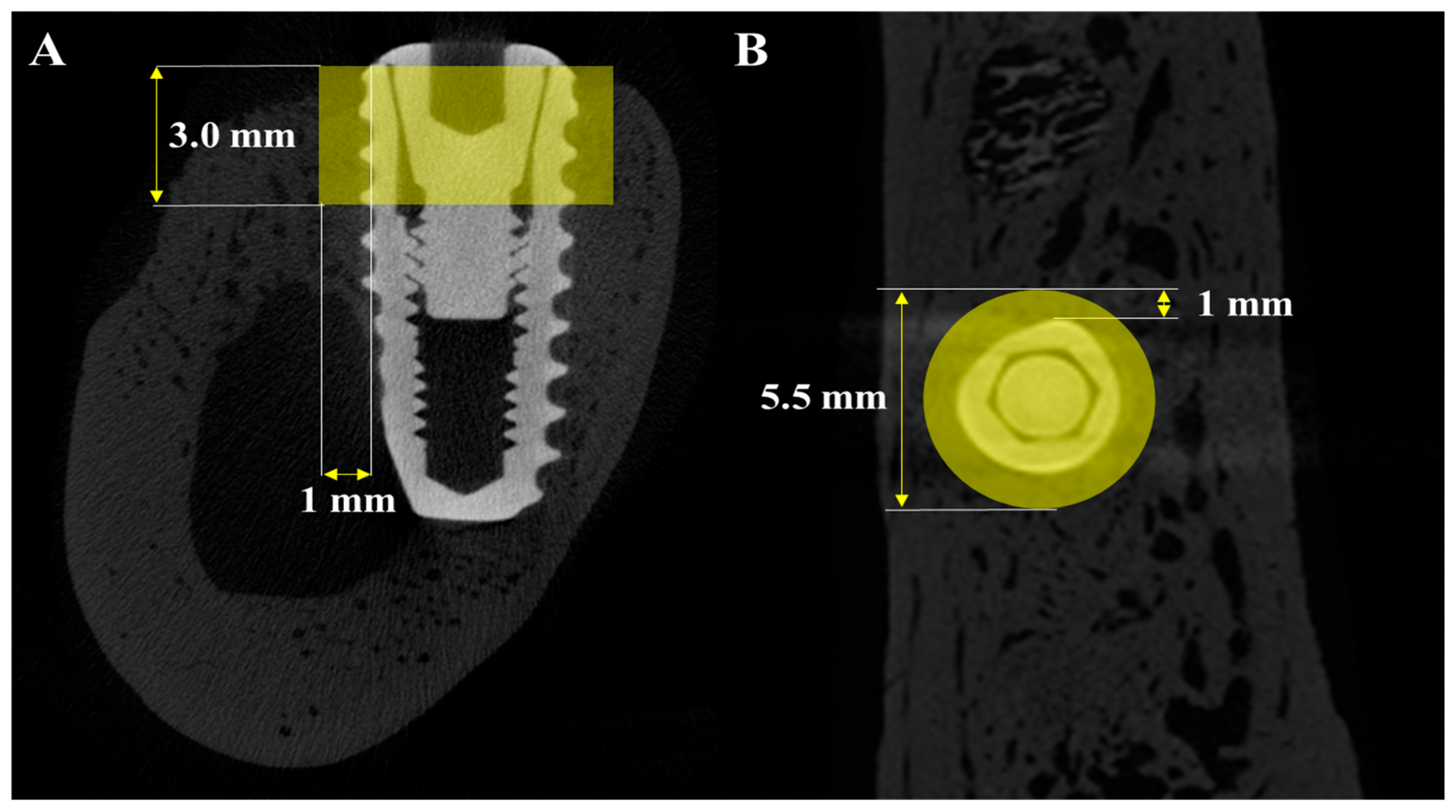 Materials 18 03582 g003