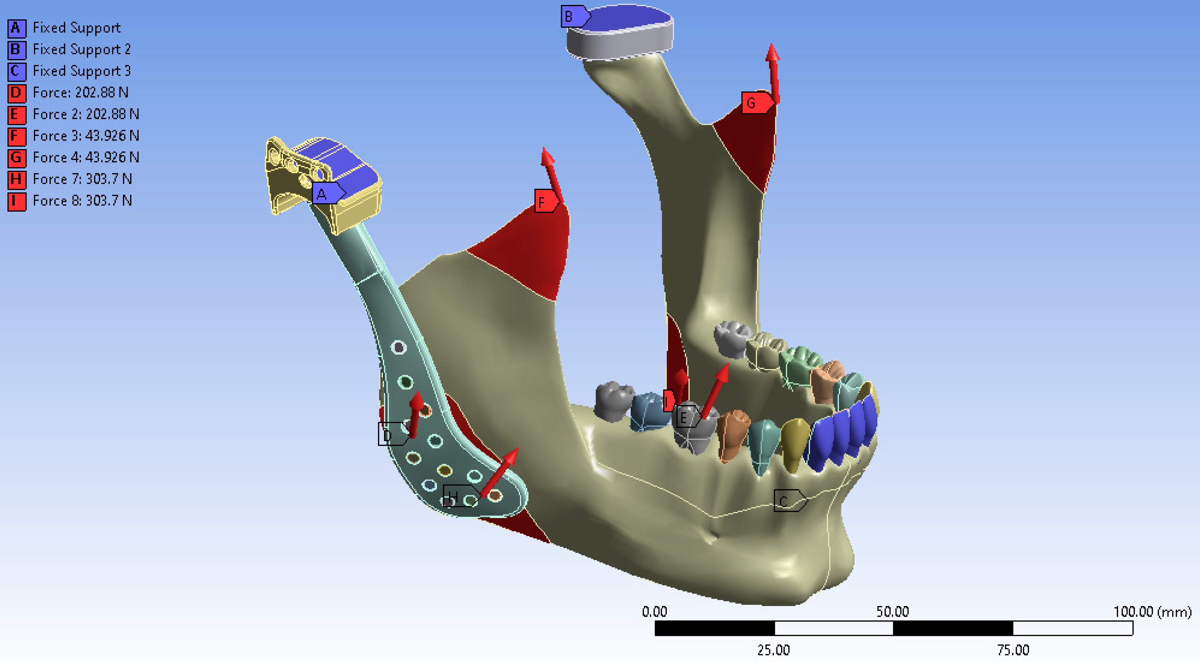 Materials 18 04822 g004 Materials 18 04822 g004