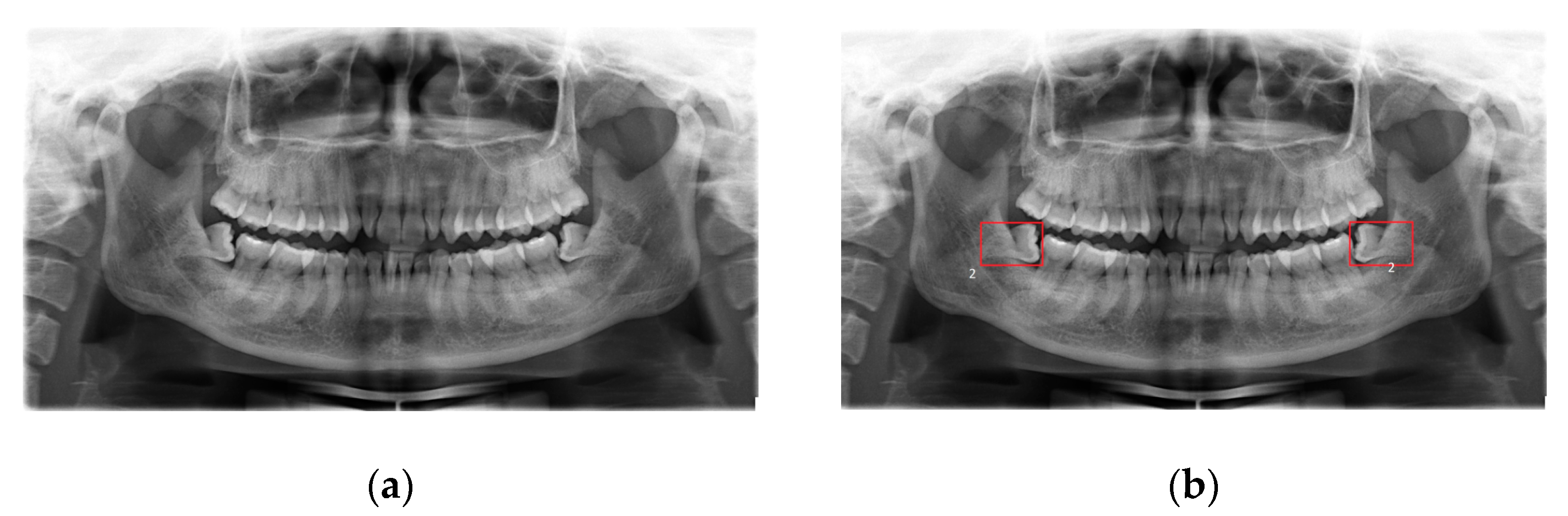 Mathematics 08 00707 g003