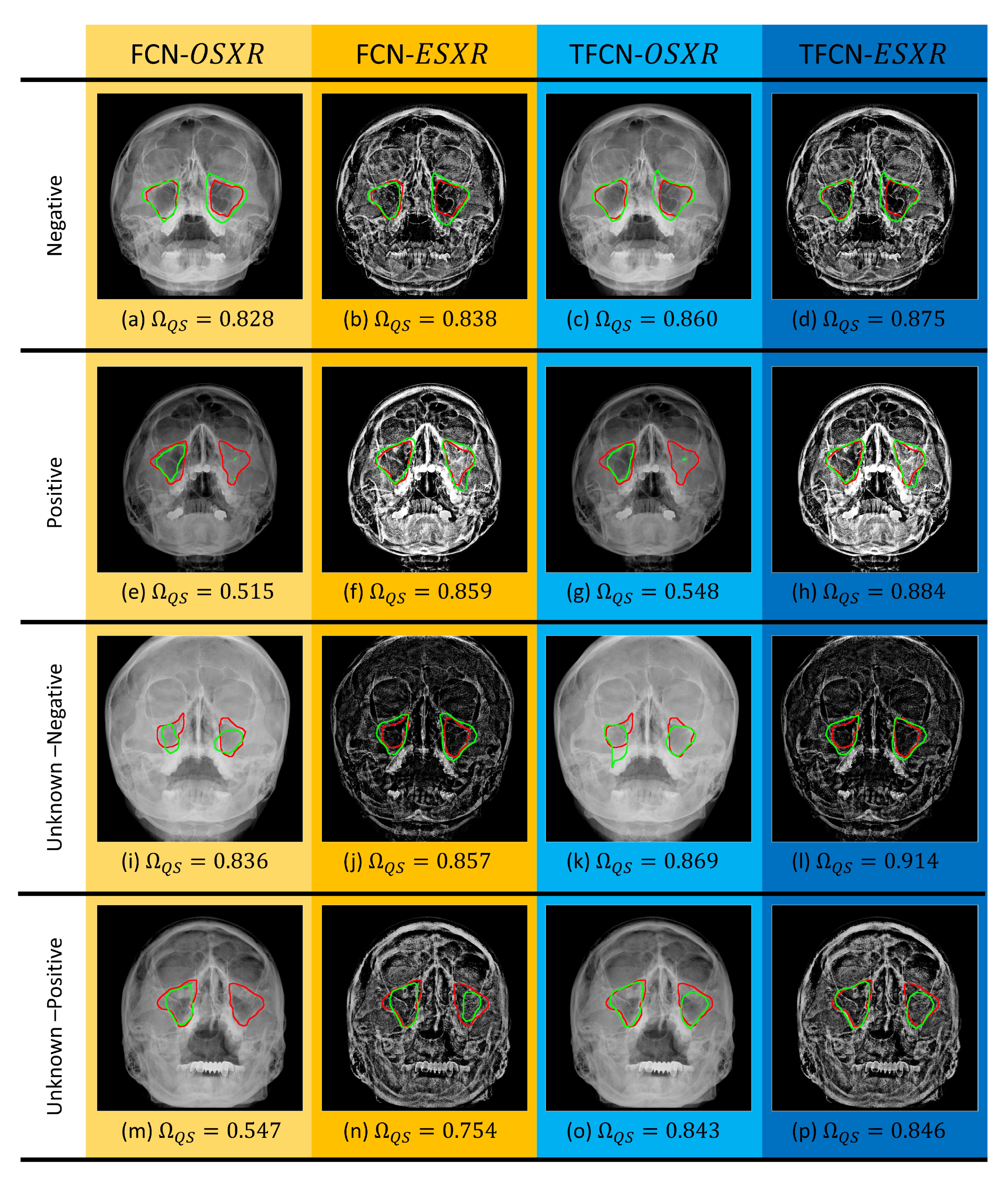 Mathematics 08 00768 g004 Mathematics 08 00768 g004