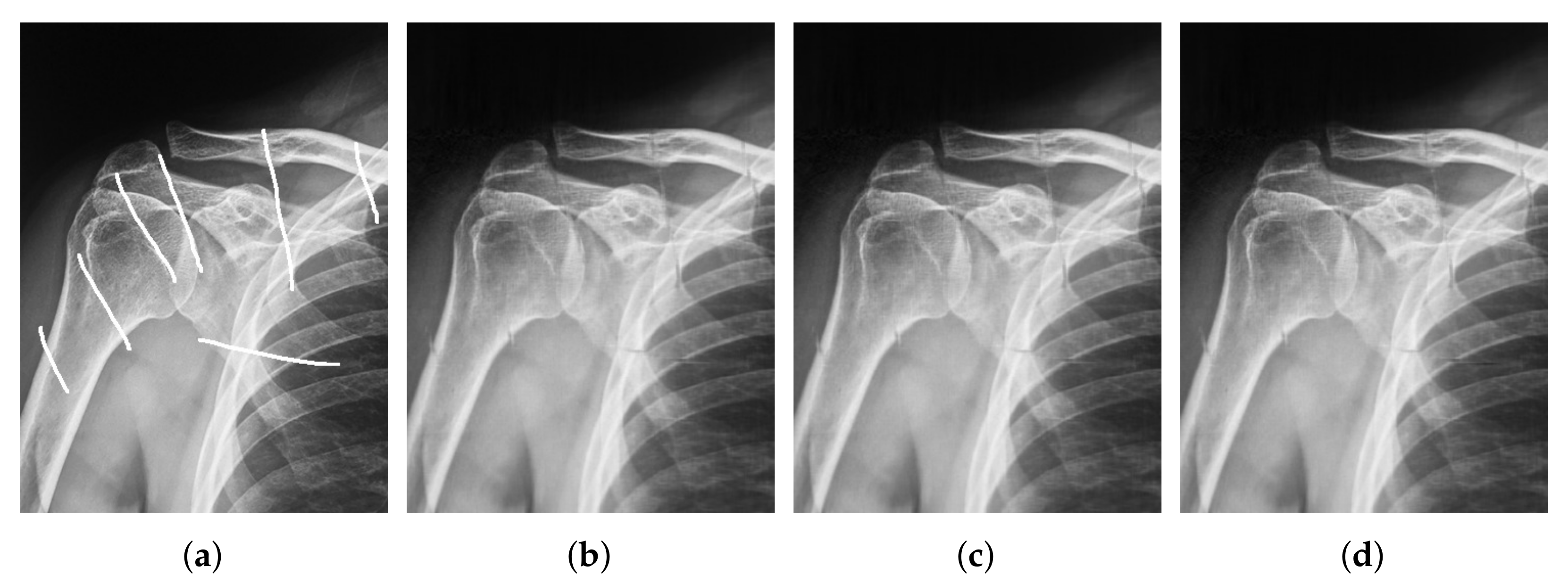 Mathematics 09 00890 g004