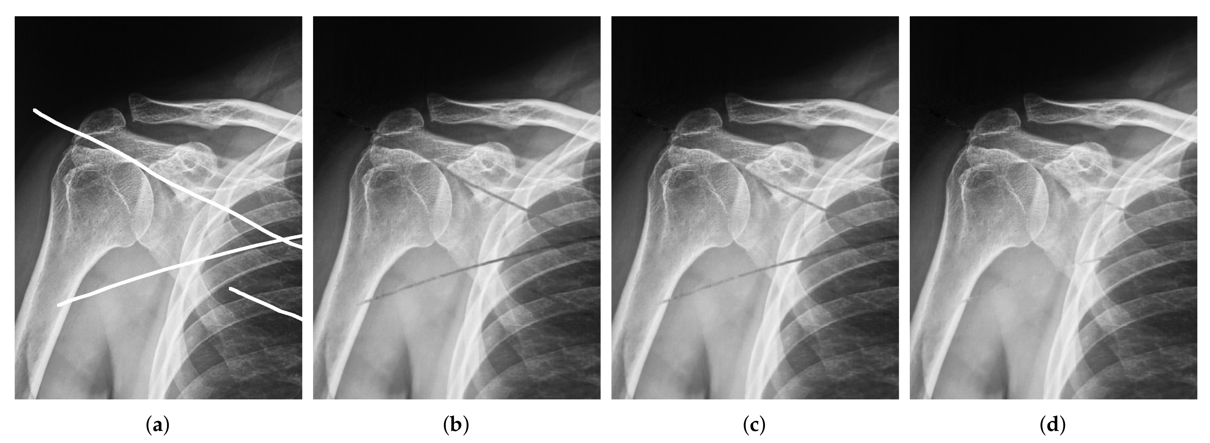 Mathematics 09 00890 g008