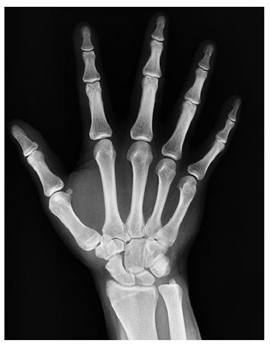 Mathematics 10 02421 i005