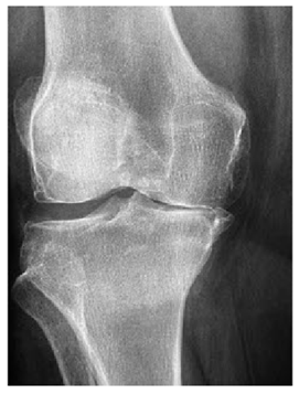 Mathematics 10 02421 i007