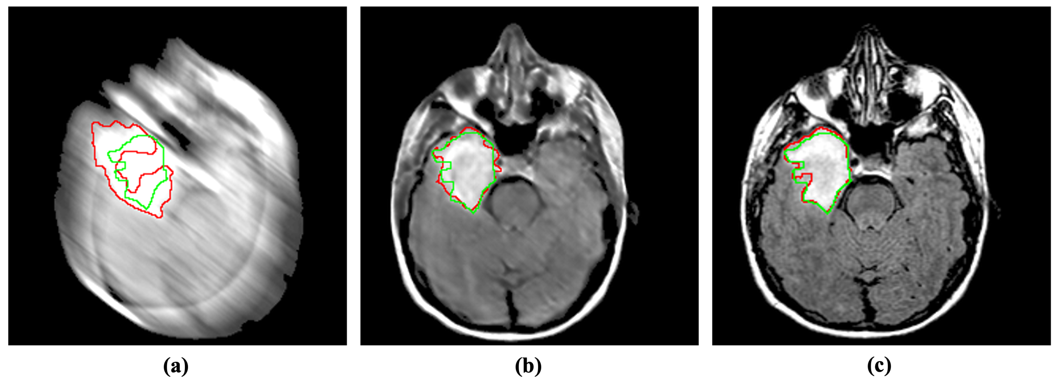 Mathematics 11 00115 g006 Mathematics 11 00115 g006
