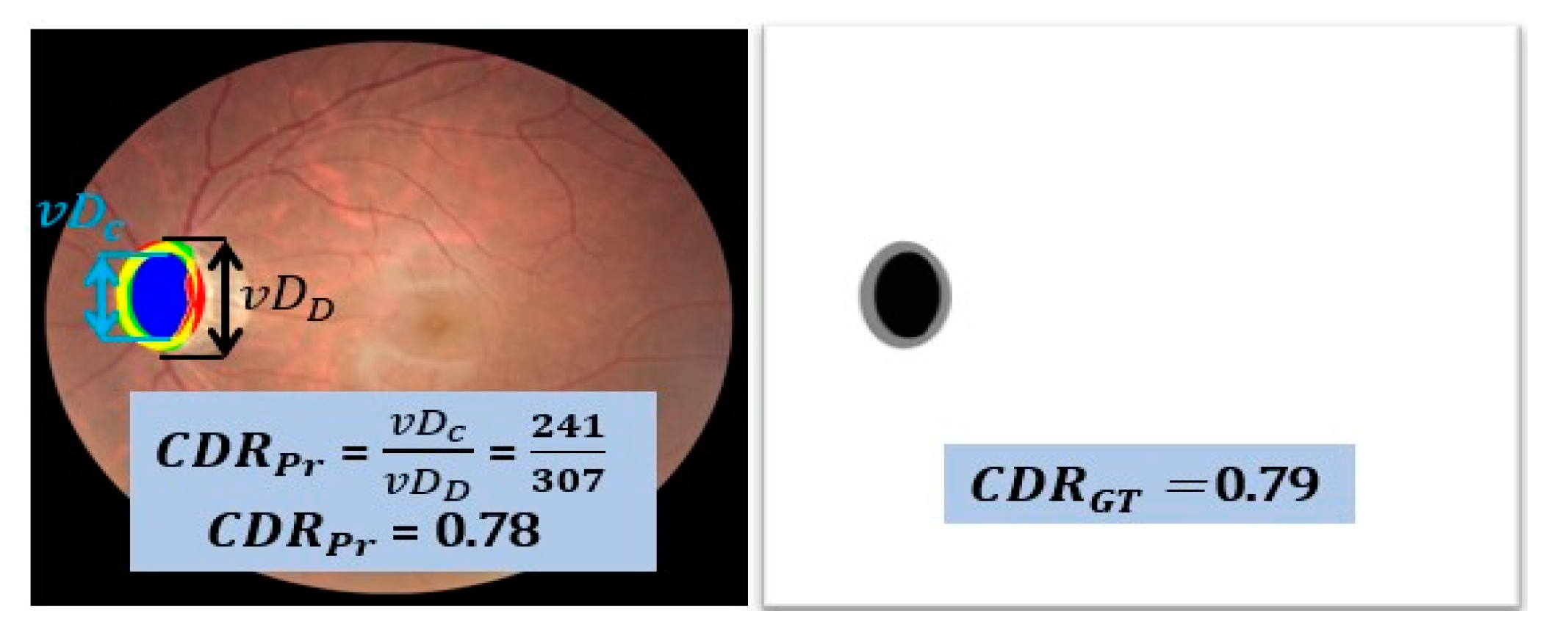Mathematics 11 00257 g012