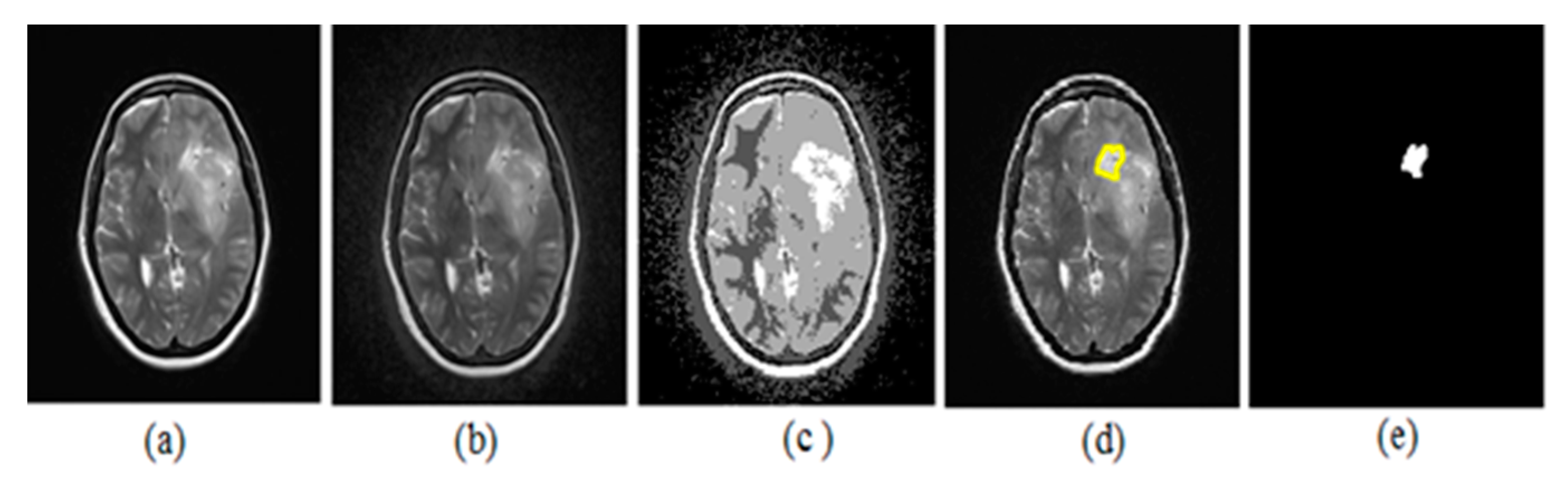 Mathematics 11 00285 g010
