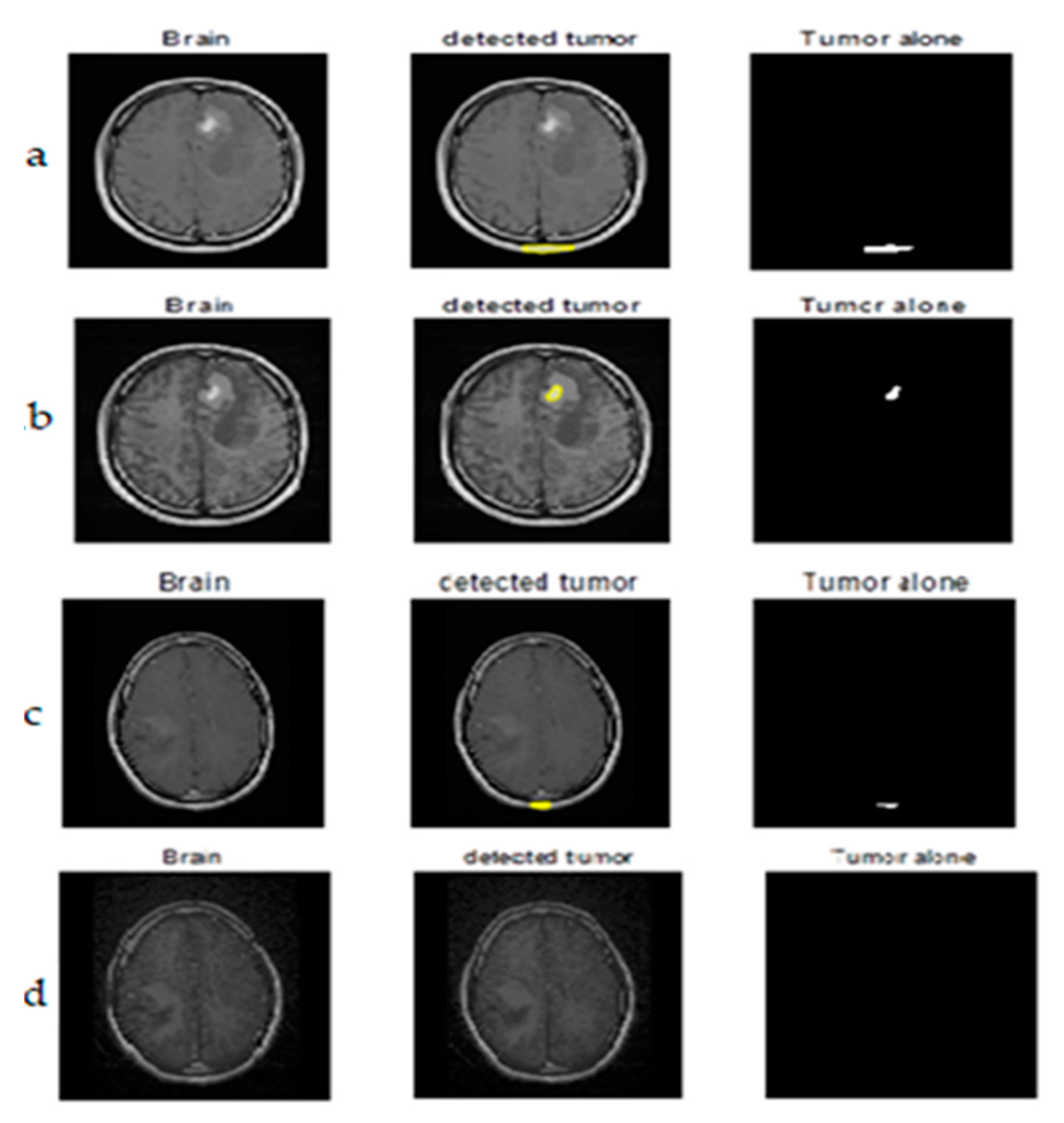 Mathematics 11 00285 g011