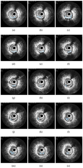Mathematics 11 00537 g0a1