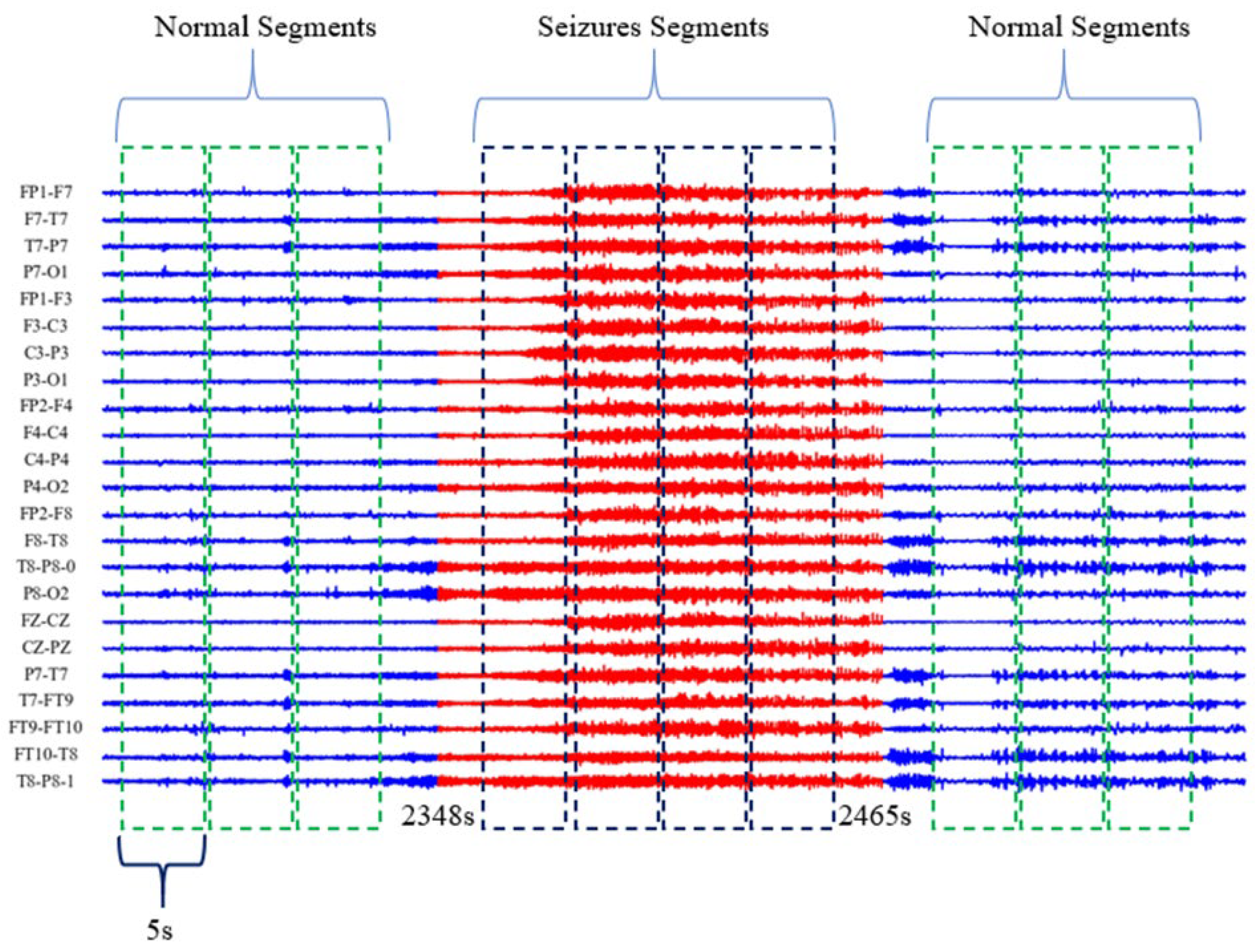 Mathematics 11 01438 g006