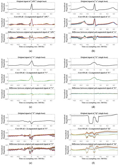 Mathematics 11 01833 g0a6