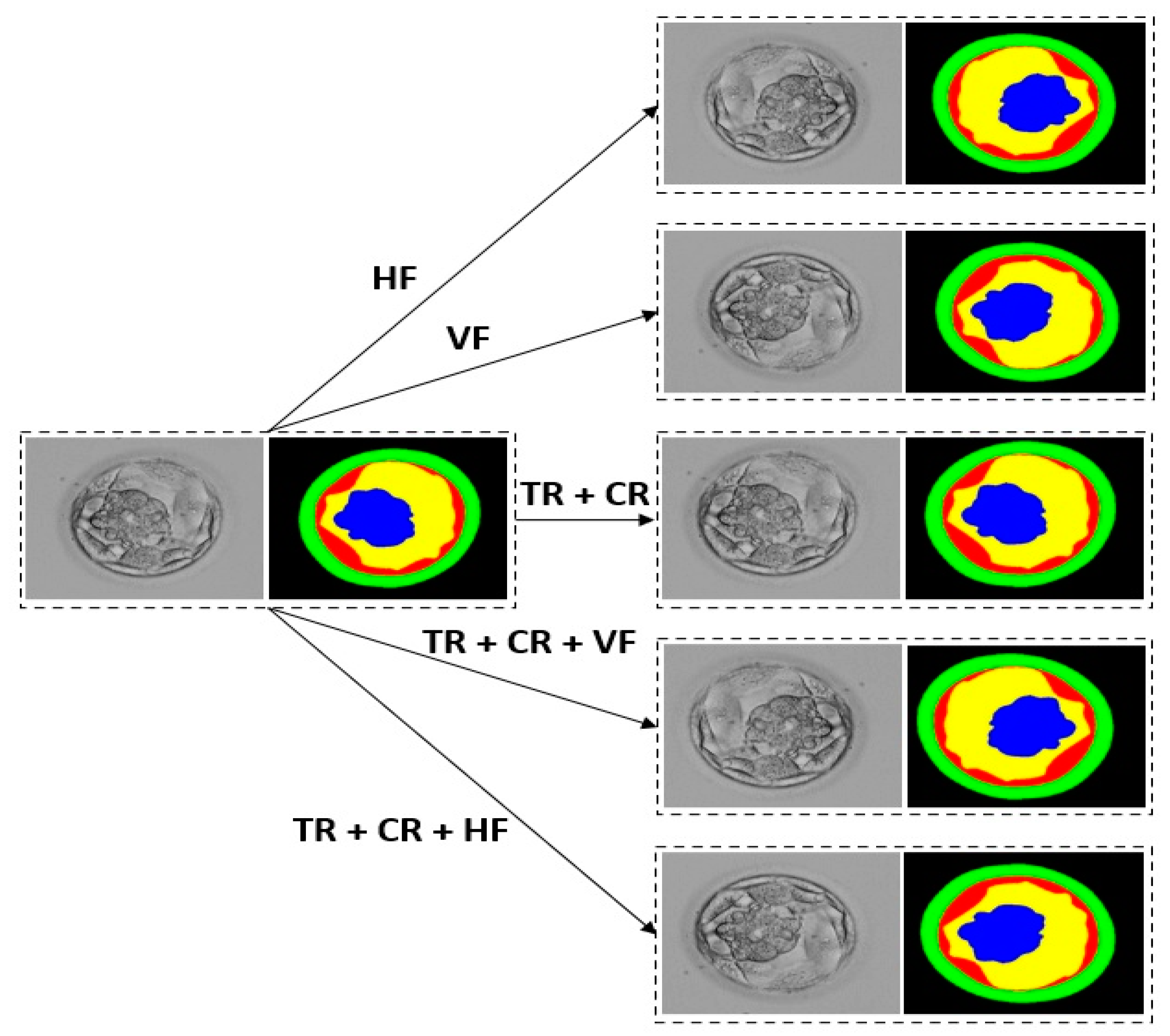 Mathematics 11 02023 g006