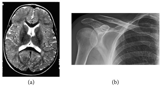 Mathematics 11 02107 g002