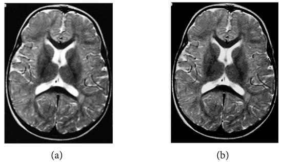 Mathematics 11 02107 g004