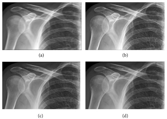 Mathematics 11 02107 g006