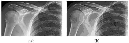 Mathematics 11 02107 g007