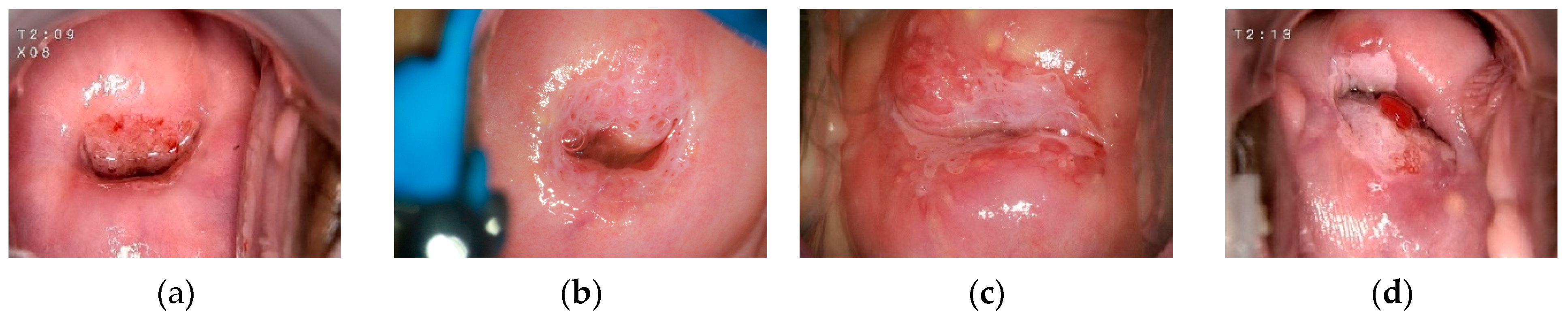 Mathematics 11 03689 g008