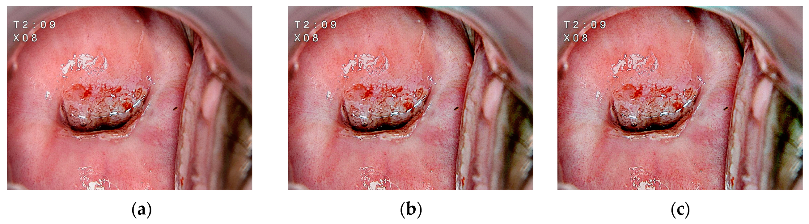 Mathematics 11 03689 g011