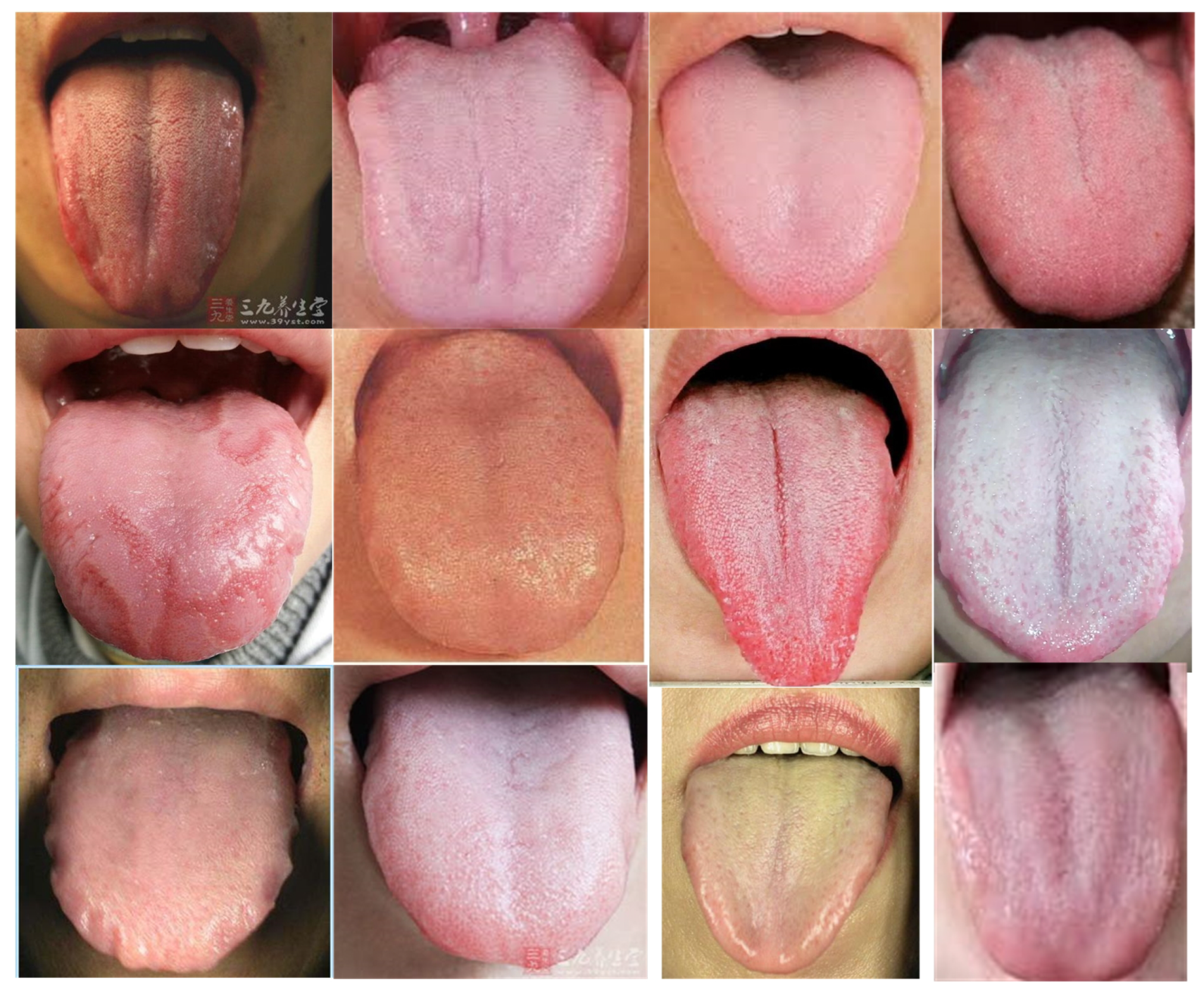 Mathematics 11 04908 g004