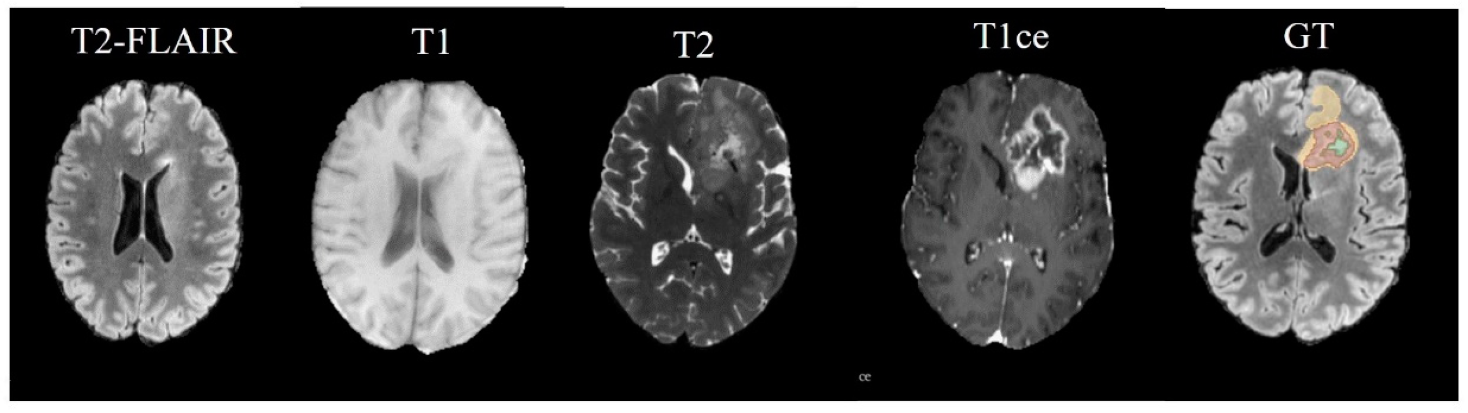 Mathematics 13 00160 g004