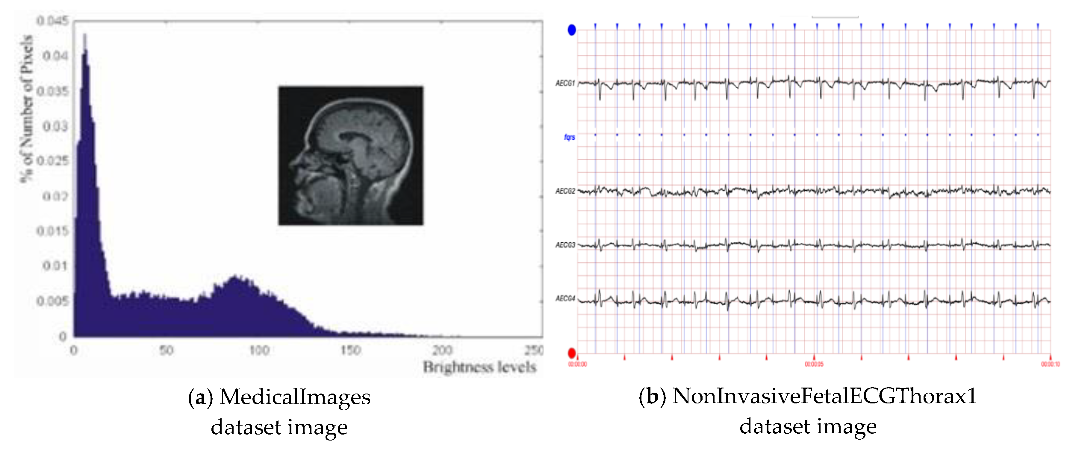 Mathematics 13 00233 g013