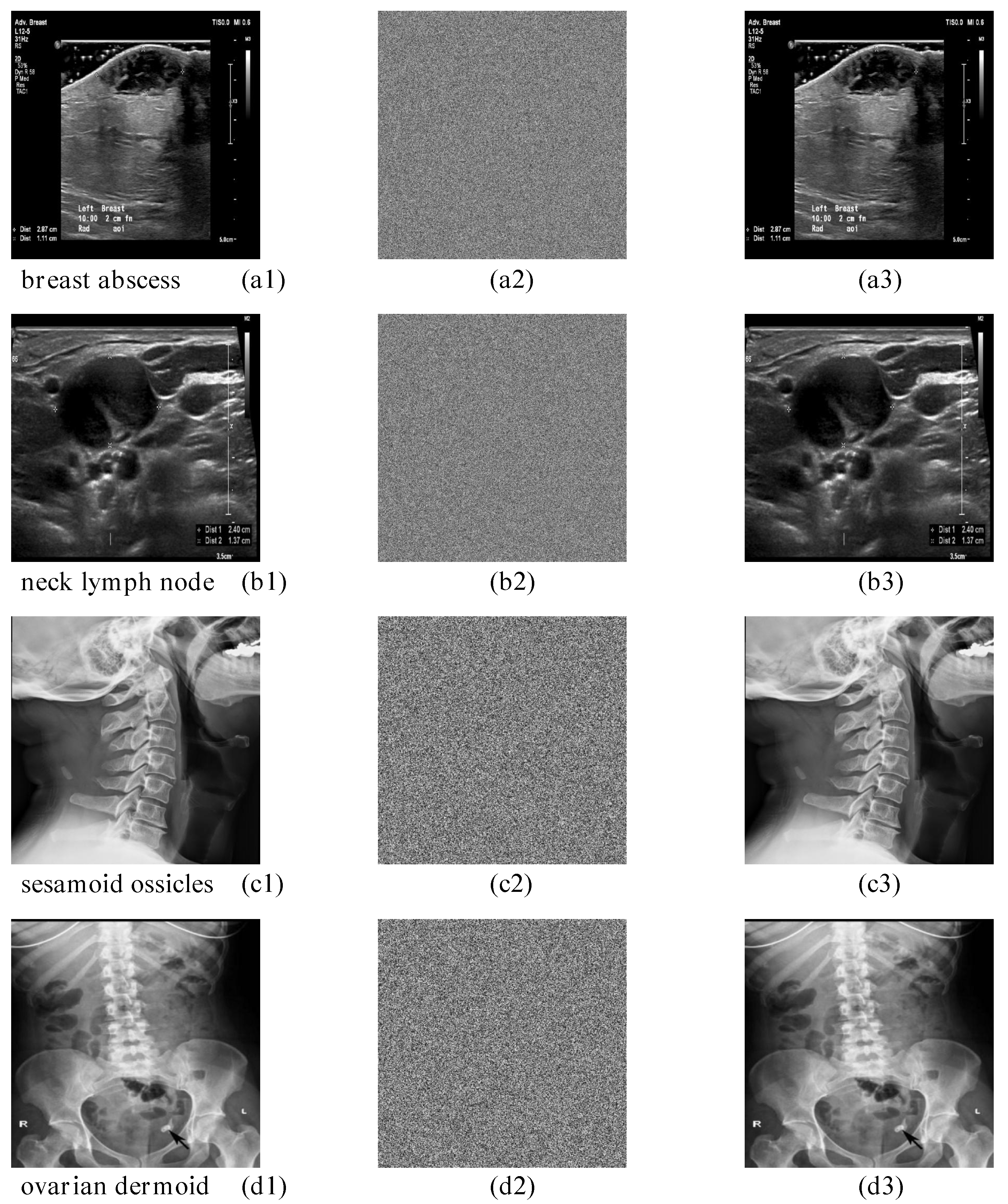 Mathematics 13 02571 g012