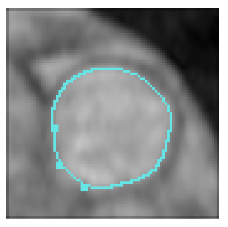 Mca 27 00026 g003