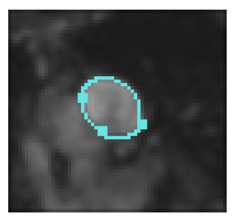 Mca 27 00026 g006