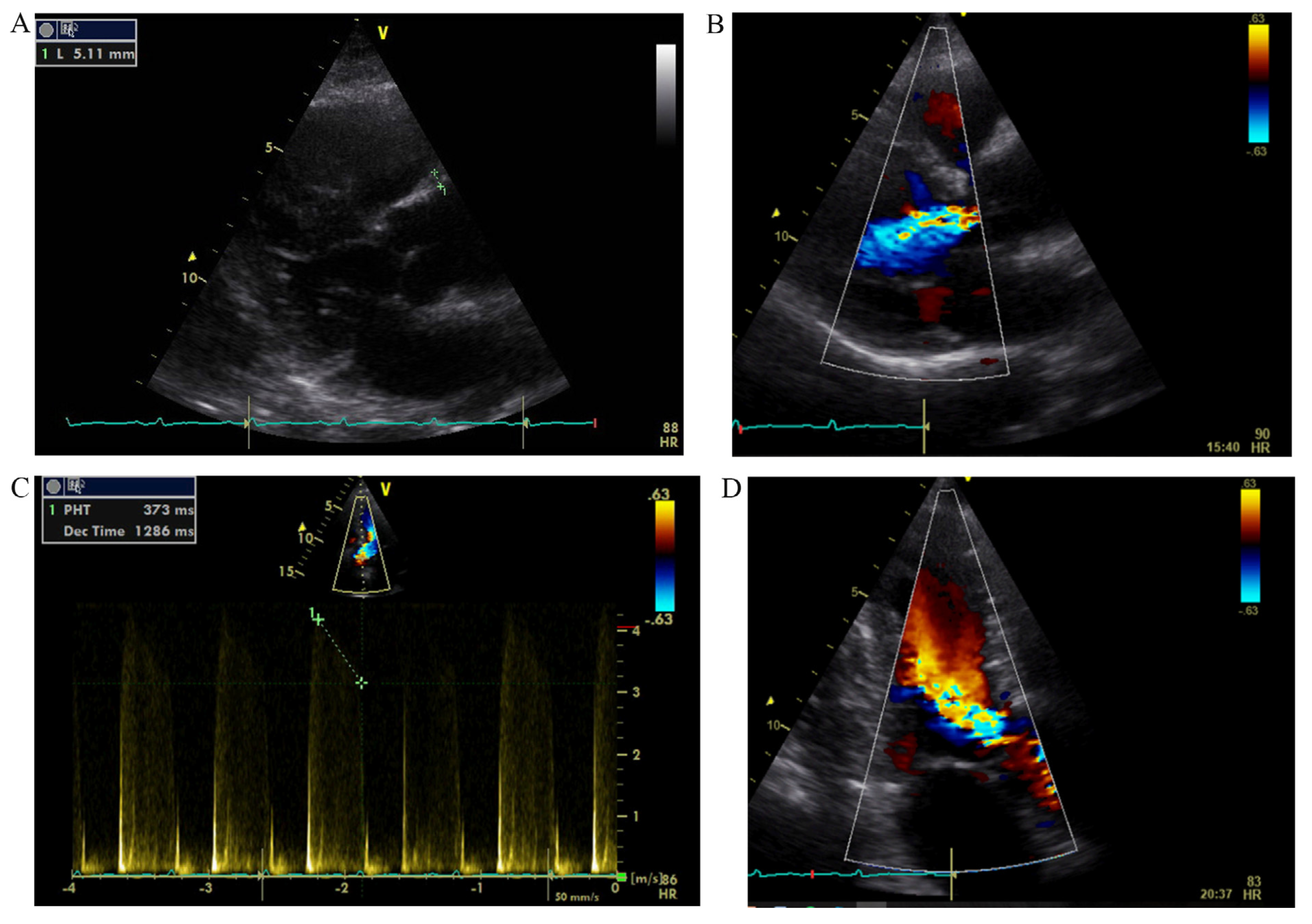Medicina 53 00211 g002