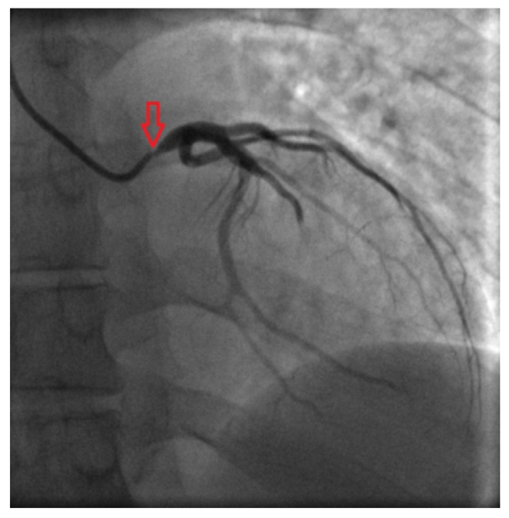 Medicina 53 00211 g003