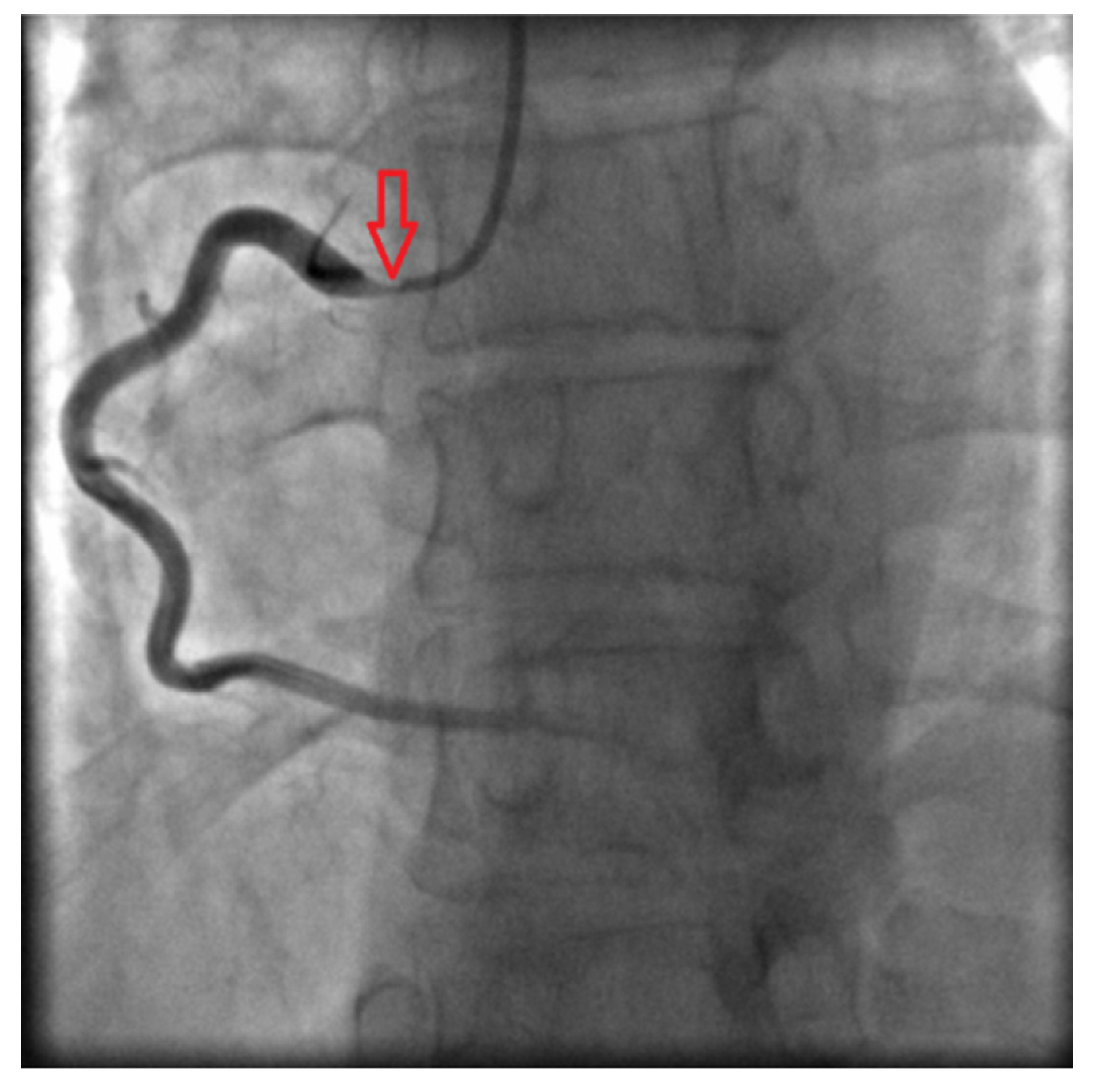 Medicina 53 00211 g004