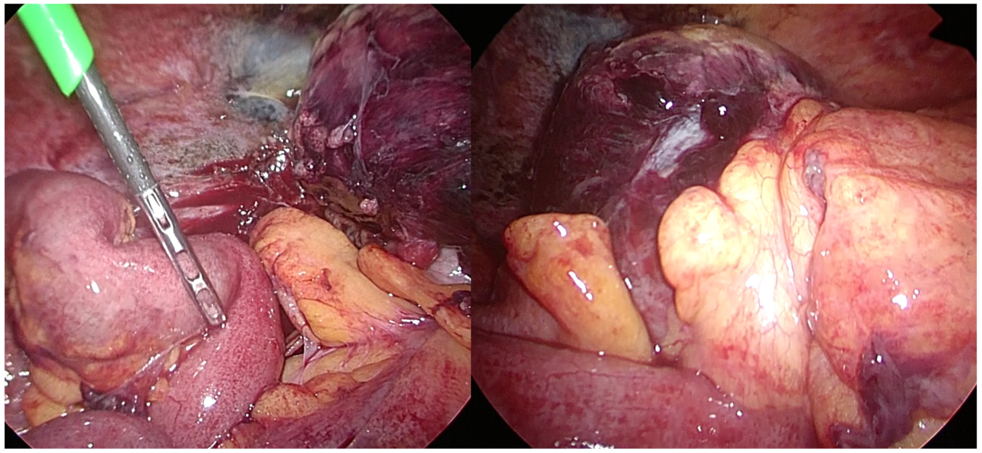 Medicina 55 00009 g002 Medicina 55 00009 g002