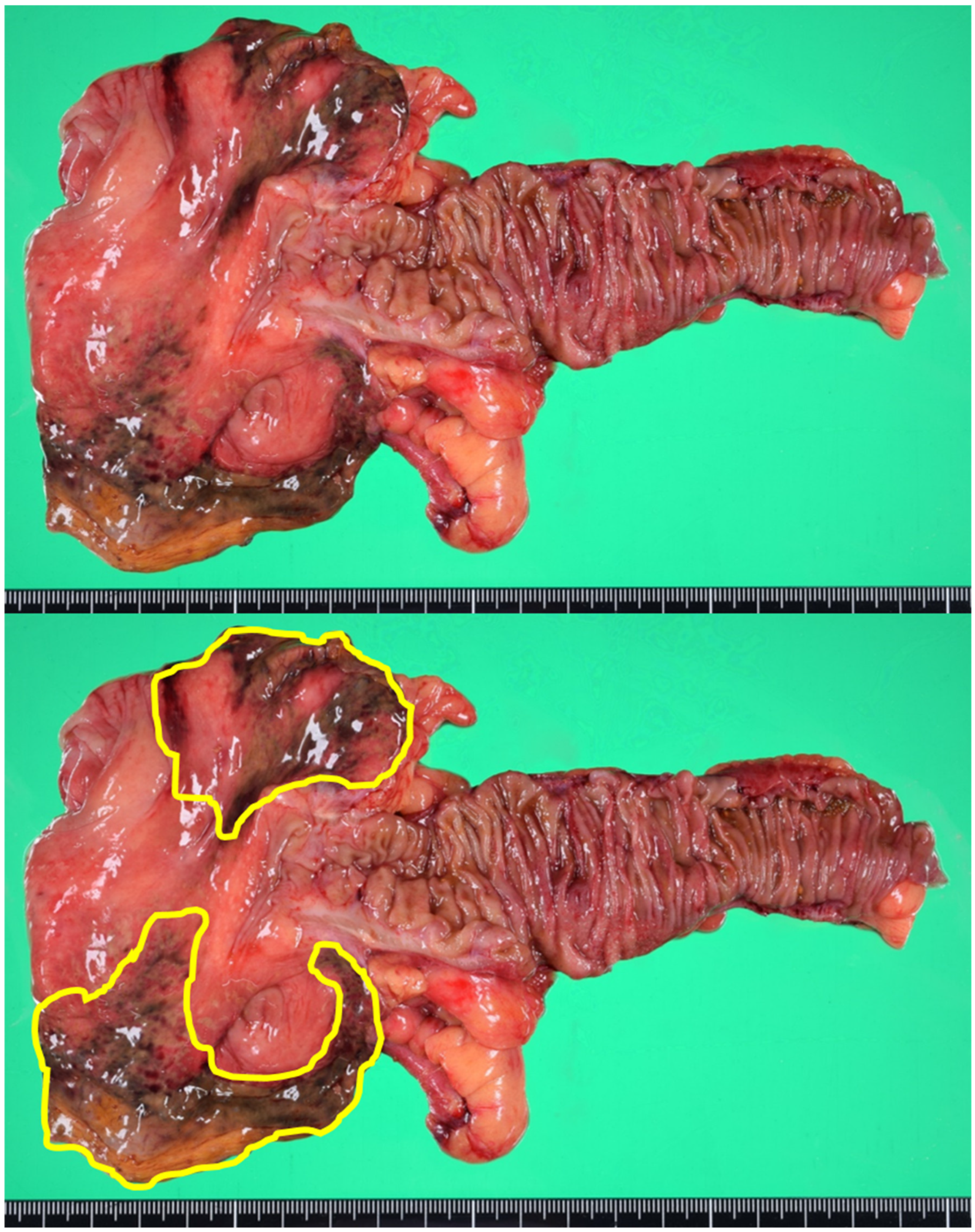 Medicina 55 00009 g003 Medicina 55 00009 g003