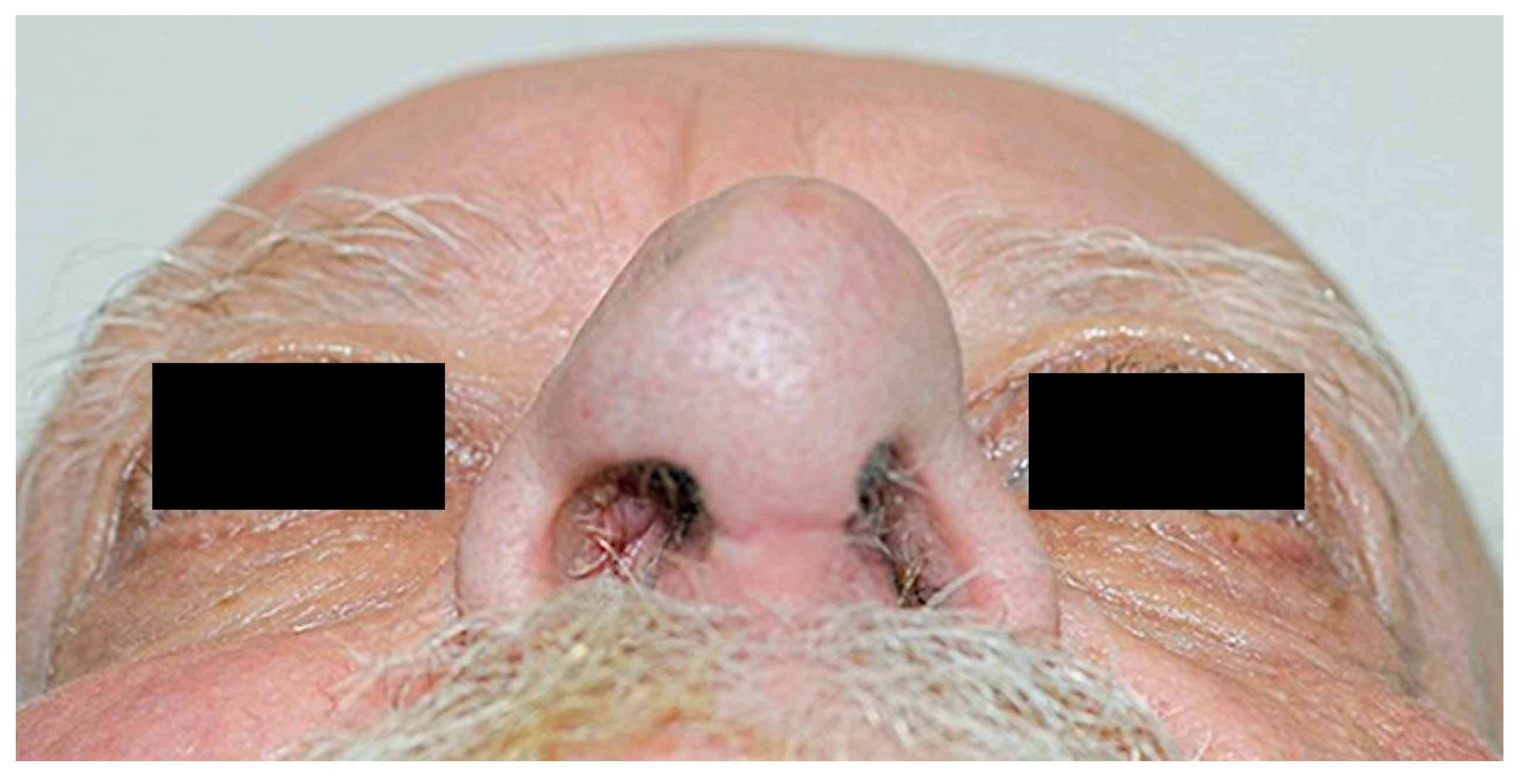 Medicina 55 00128 g008