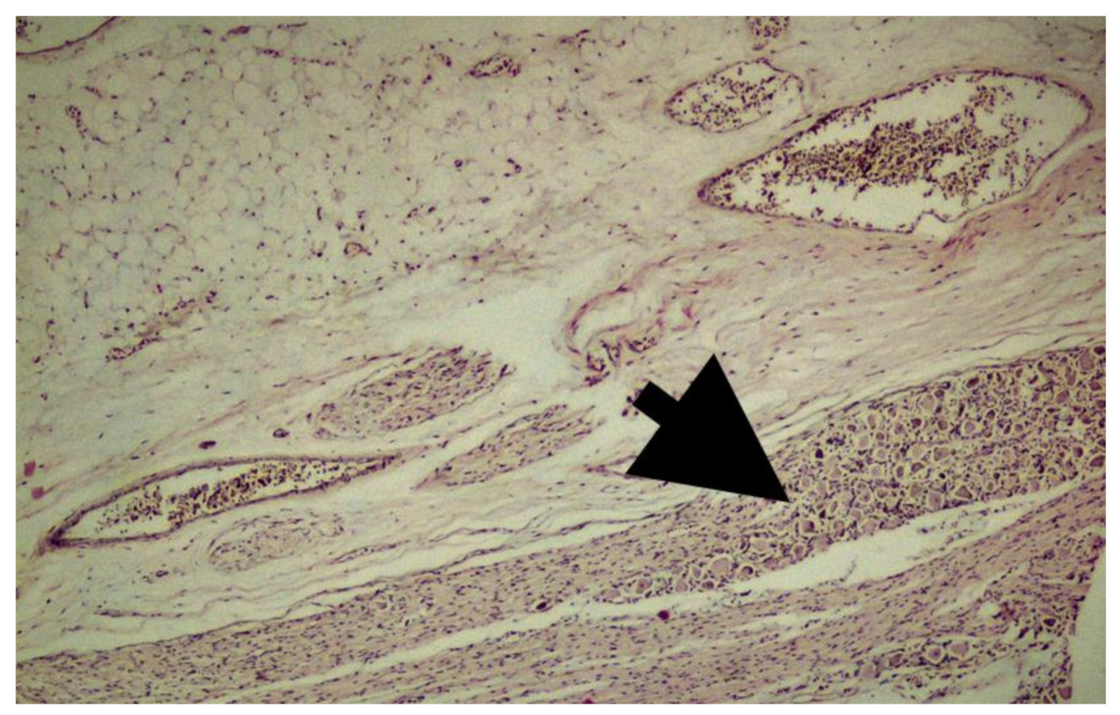 Medicina 55 00133 g004 Medicina 55 00133 g004