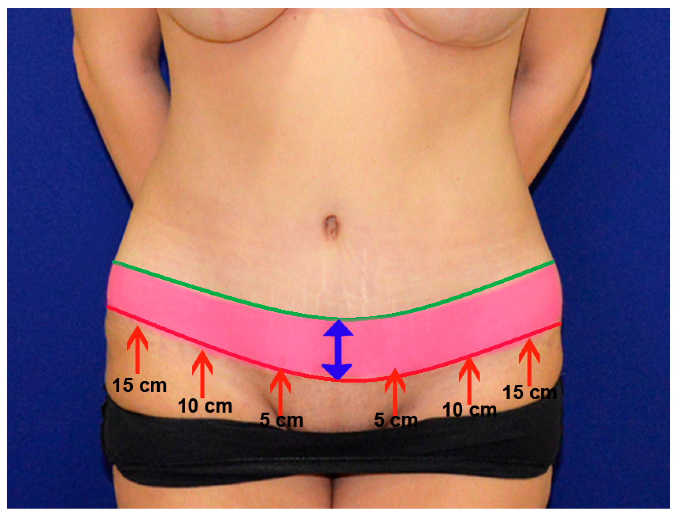 Medicina 55 00142 g003 Medicina 55 00142 g003